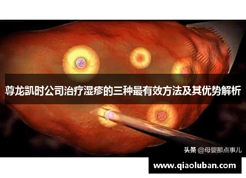 尊龙凯时公司治疗湿疹的三种最有效方法及其优势解析